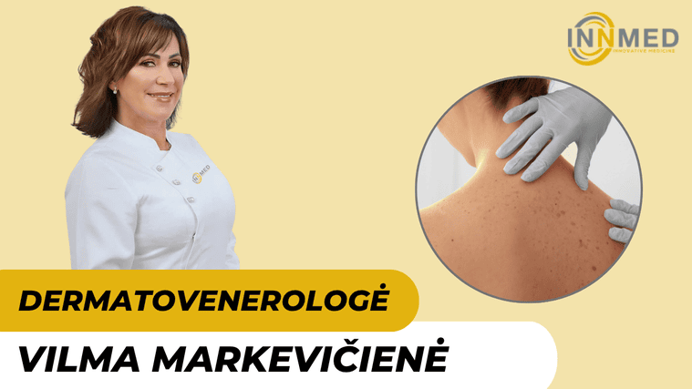 Dermatovenerologė Vilma Markevičienė InnMed klinikoje 1 VILMA MARKEVIČIENĖ